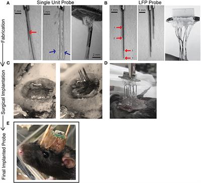 Chronic, Multi-Site Recordings Supported by Two Low-Cost, Stationary Probe Designs Optimized to Capture Either Single Unit or Local Field Potential Activity in Behaving Rats
